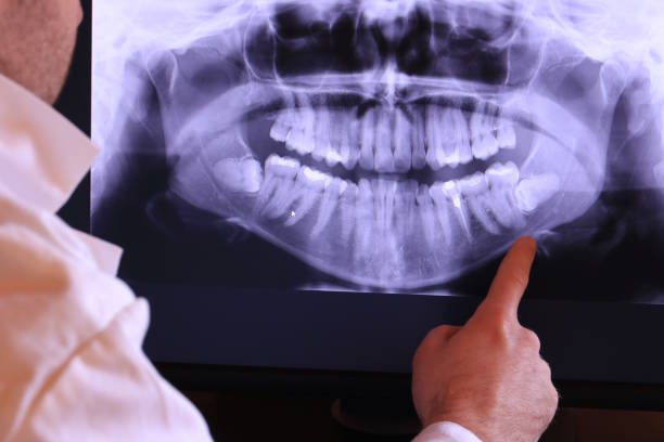 Best Emergency Root Canal Therapy in Mayodan, NC