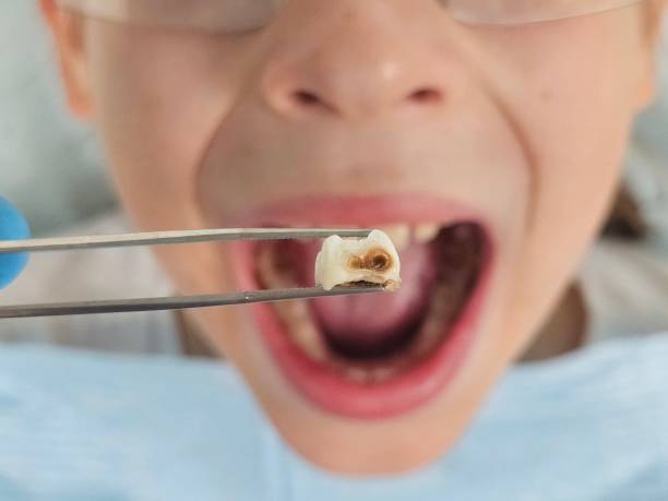 Best Emergency Cosmetic Dentistry (e.g., broken veneers) in Mayodan, NC
